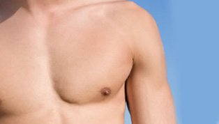 Male Breast Reduction