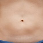 CoolSculpting Before & After Patient #1910